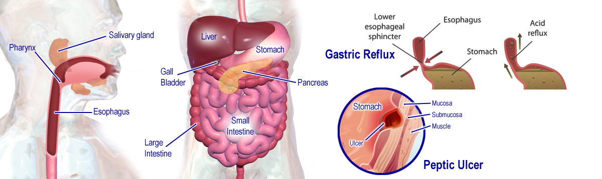 Gastric Disorders